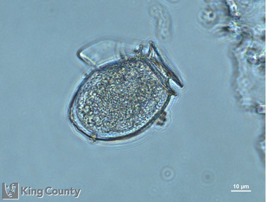 Photo of Dinophysis acuminata